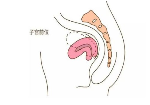 杭州试管供卵代怀：﻿11号染色体倒位对胎儿的影响很大，附11号染色体倒位的症状